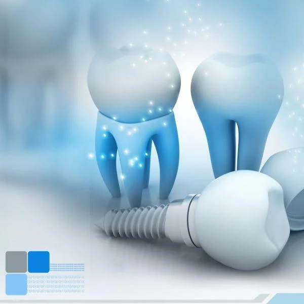 can dental implants be done in one day