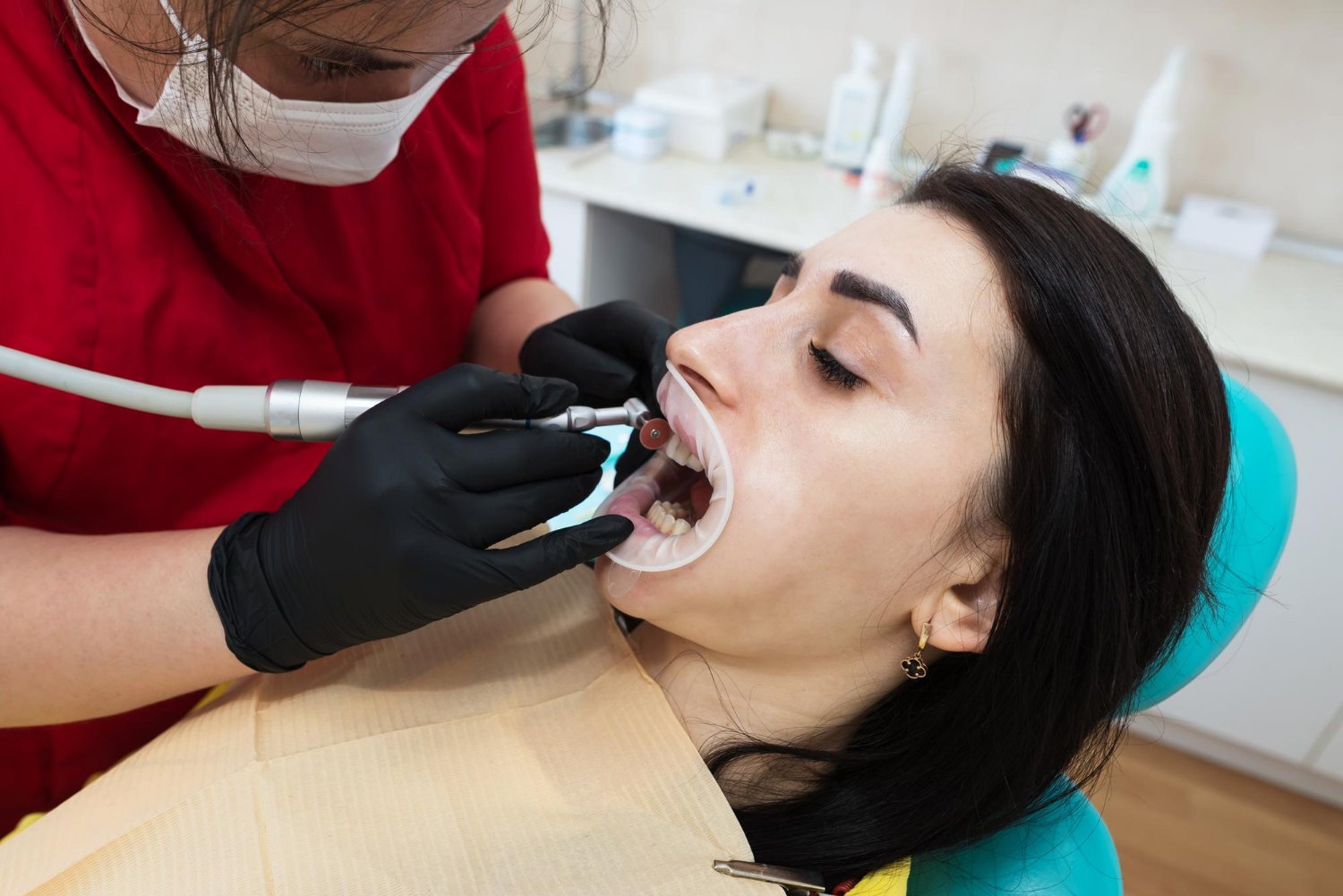 cosmetic bonding