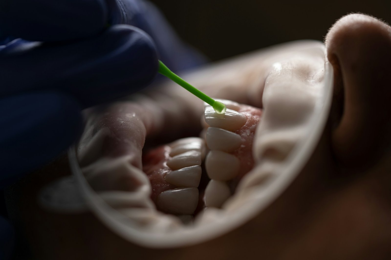 Composite Bonding