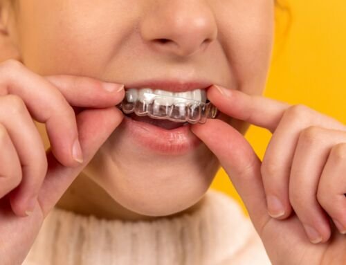 When To Consult Your Dentist About Invisalign Issues