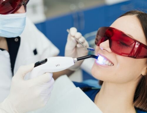 Choosing Composite Bonding in Nether Alderley Pros and Cons to Know
