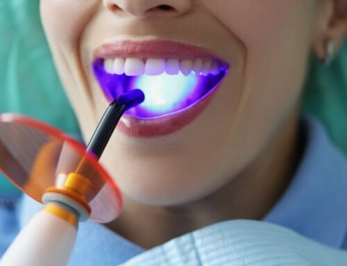 Composite Bonding in Mobberley How to Fix Small Tooth Chips Fast
