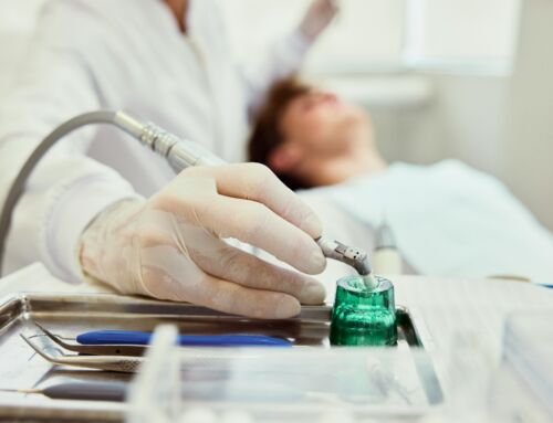 Dental Implants in Alderley Edge What Recovery Is Really Like