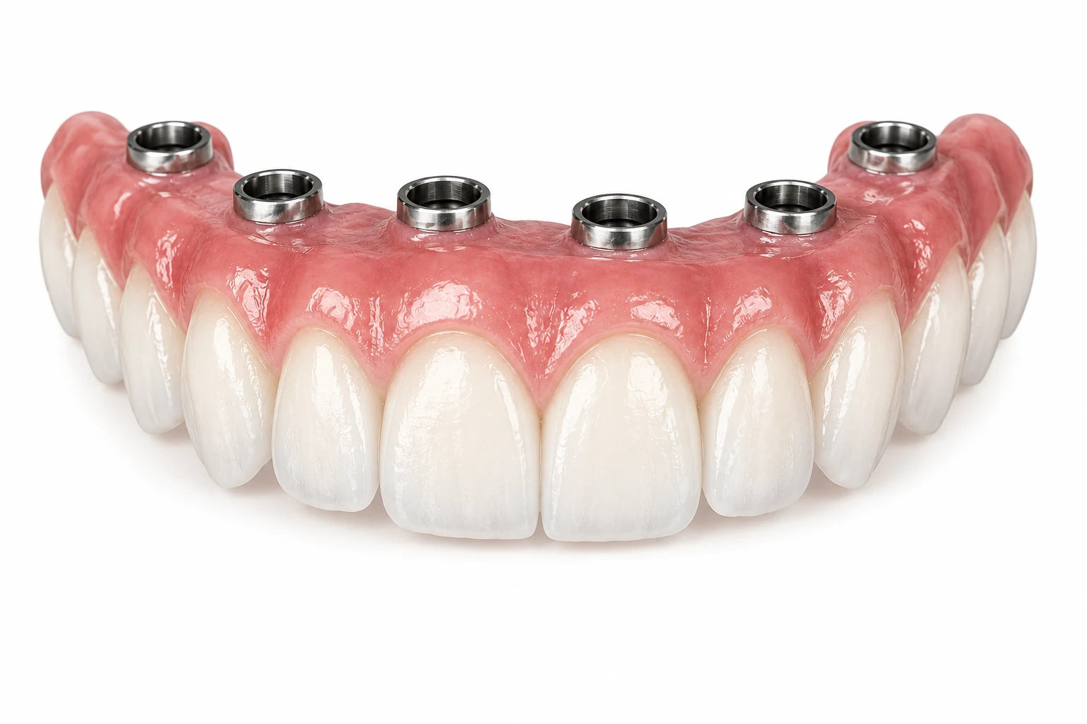 full arch dental implant the croft dental wilmslow
