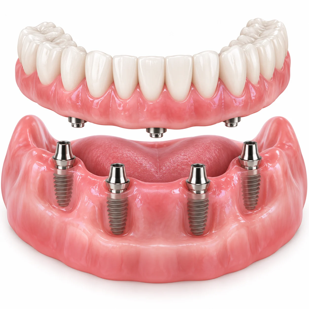 croft dental all on 4 dental implants